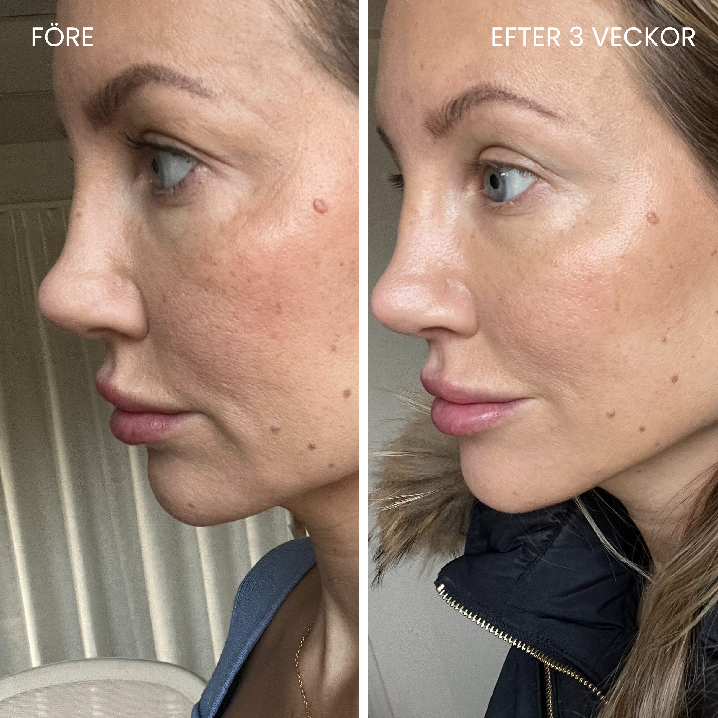 Hudboostende LED-maske