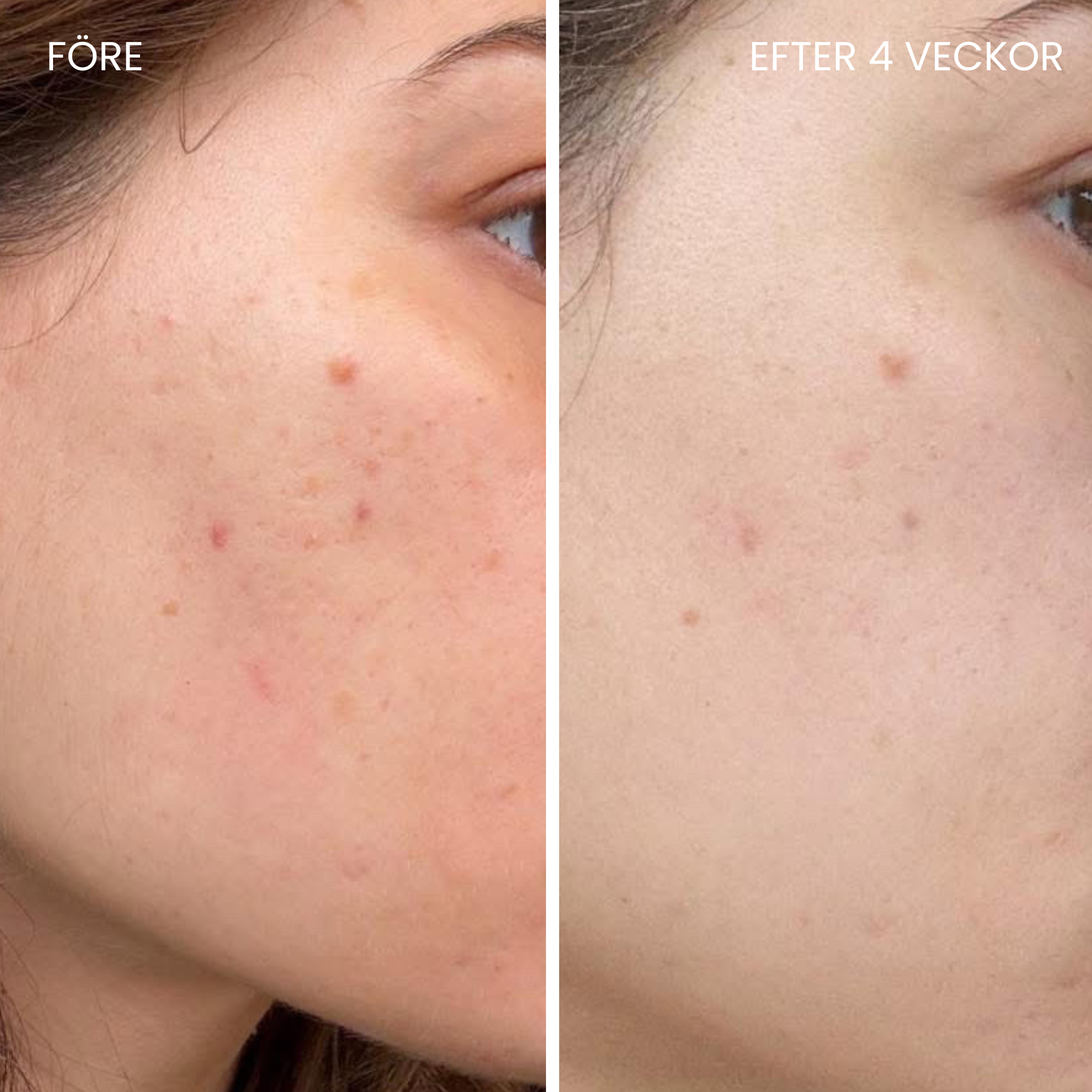 Hudboostende LED-maske