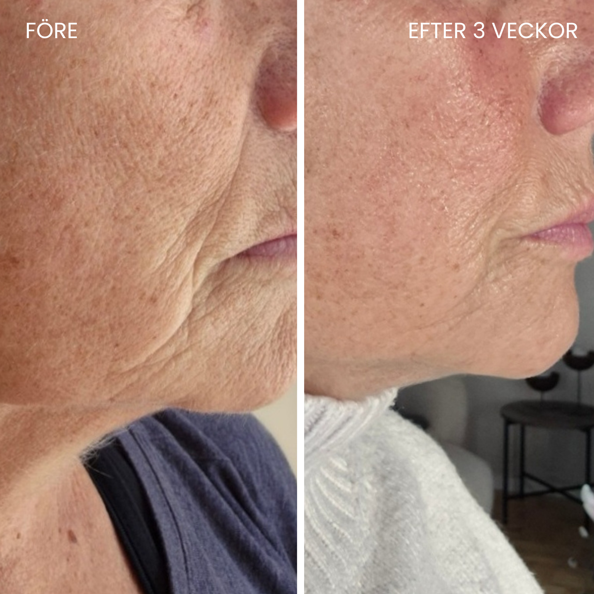 Hudboostende LED-maske