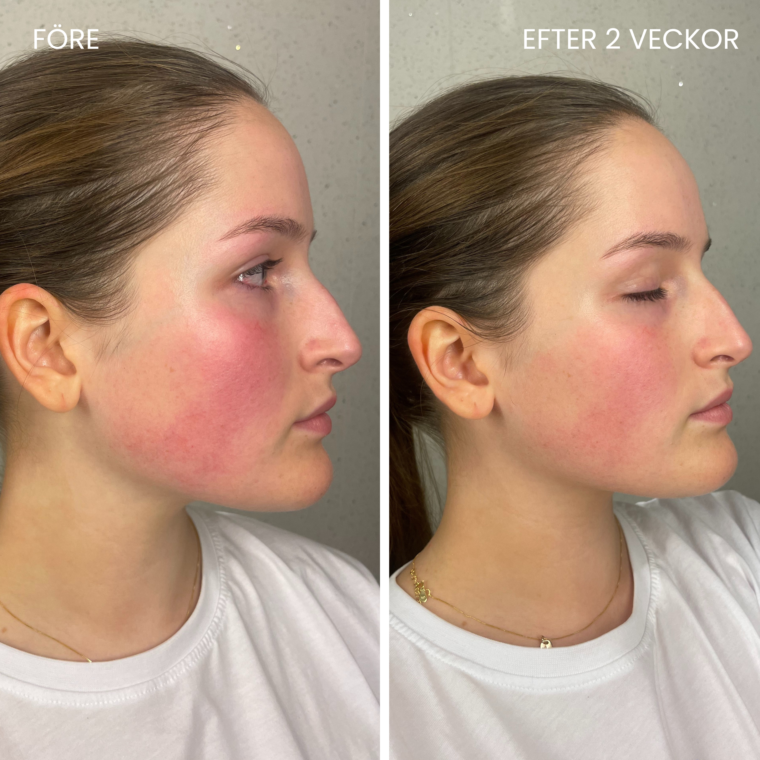 Hudboostende LED-maske