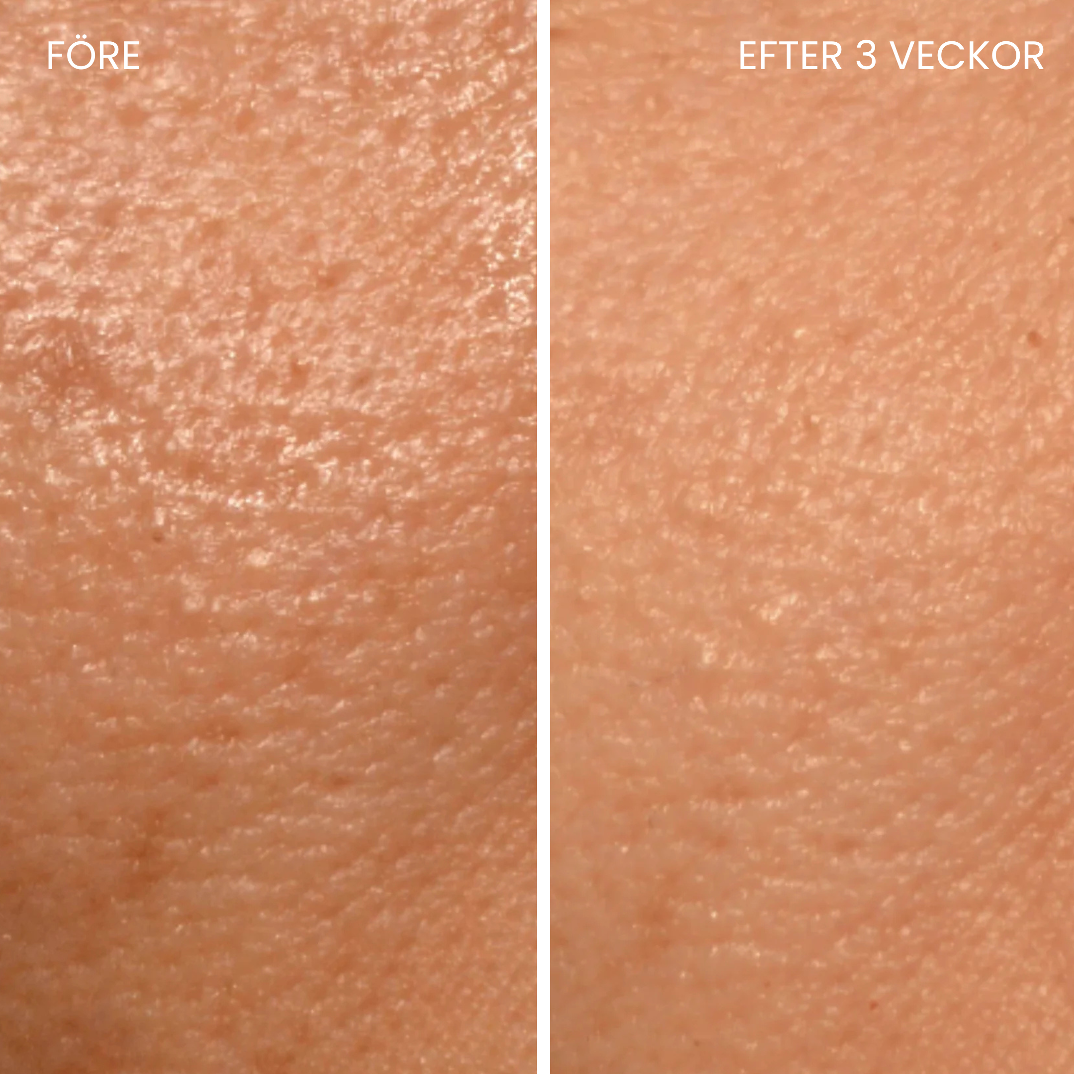 Hudboostende LED-maske