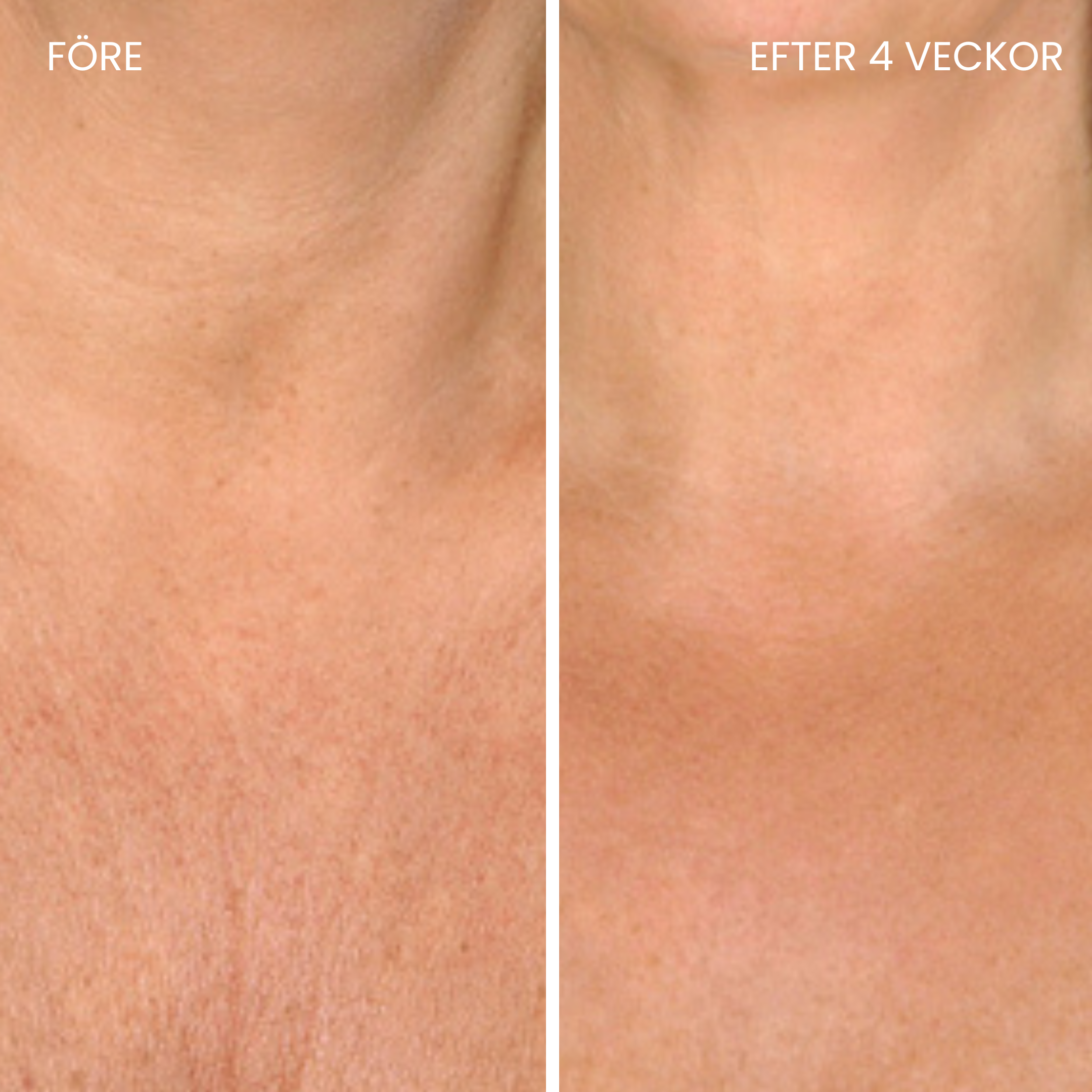 Skinboosting LED-halsbånd