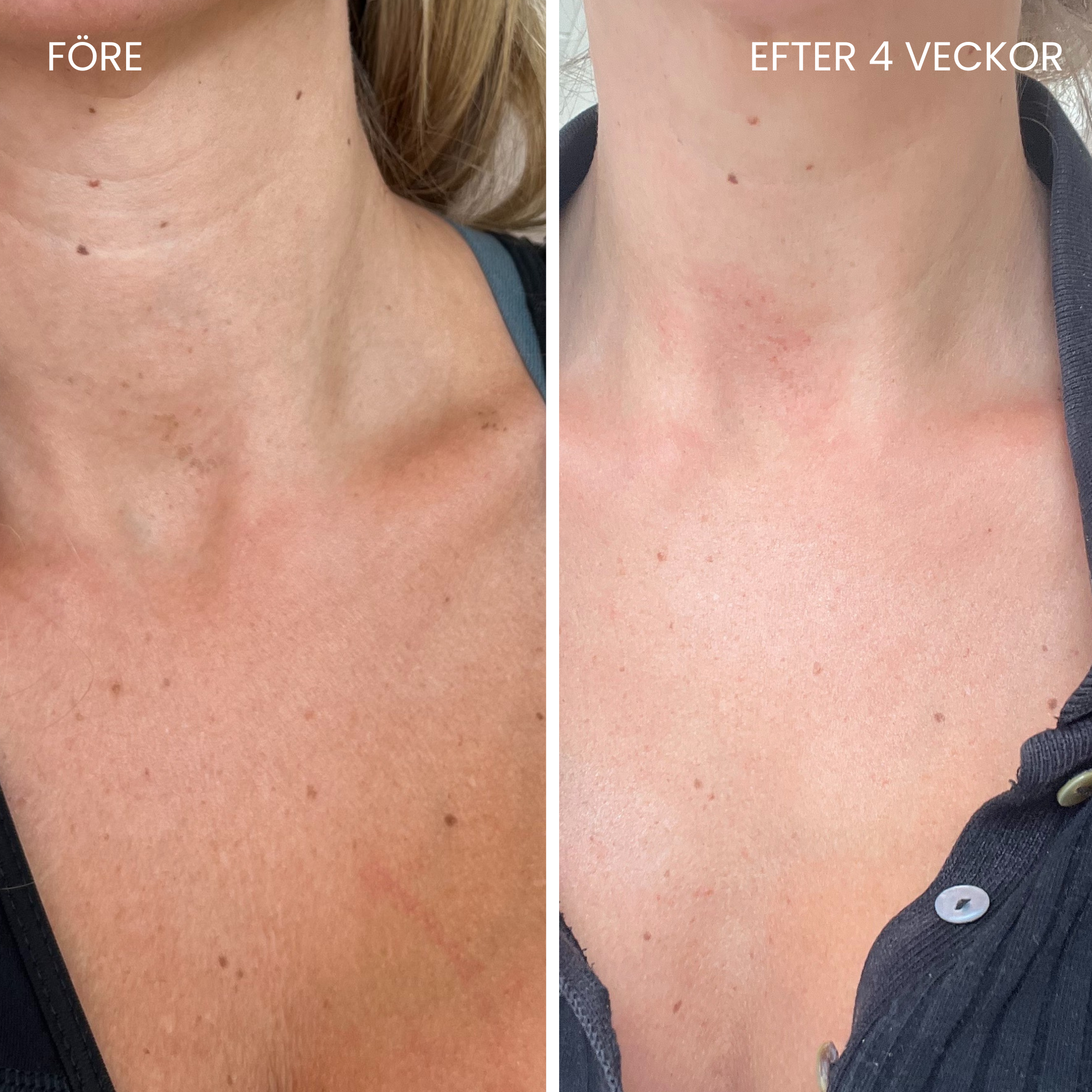 Skinboosting LED-halsbånd