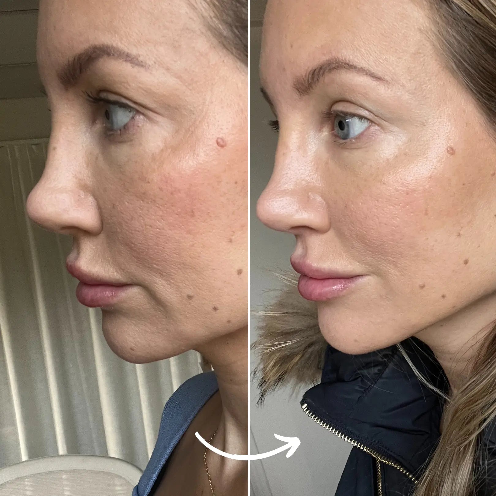 SCANDIFACE Skinboosting LED mask SCANDIFACE