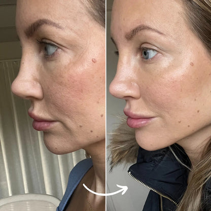 SCANDIFACE Skinboosting LED mask SCANDIFACE