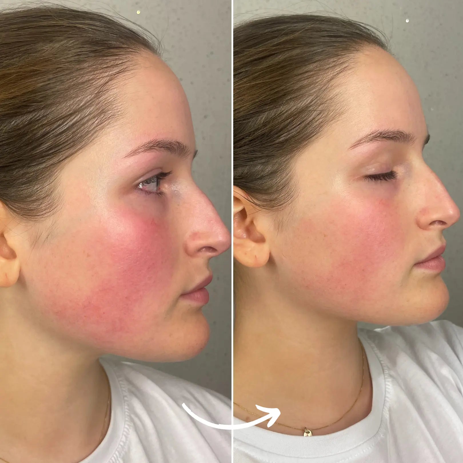 SCANDIFACE Skinboosting LED mask SCANDIFACE