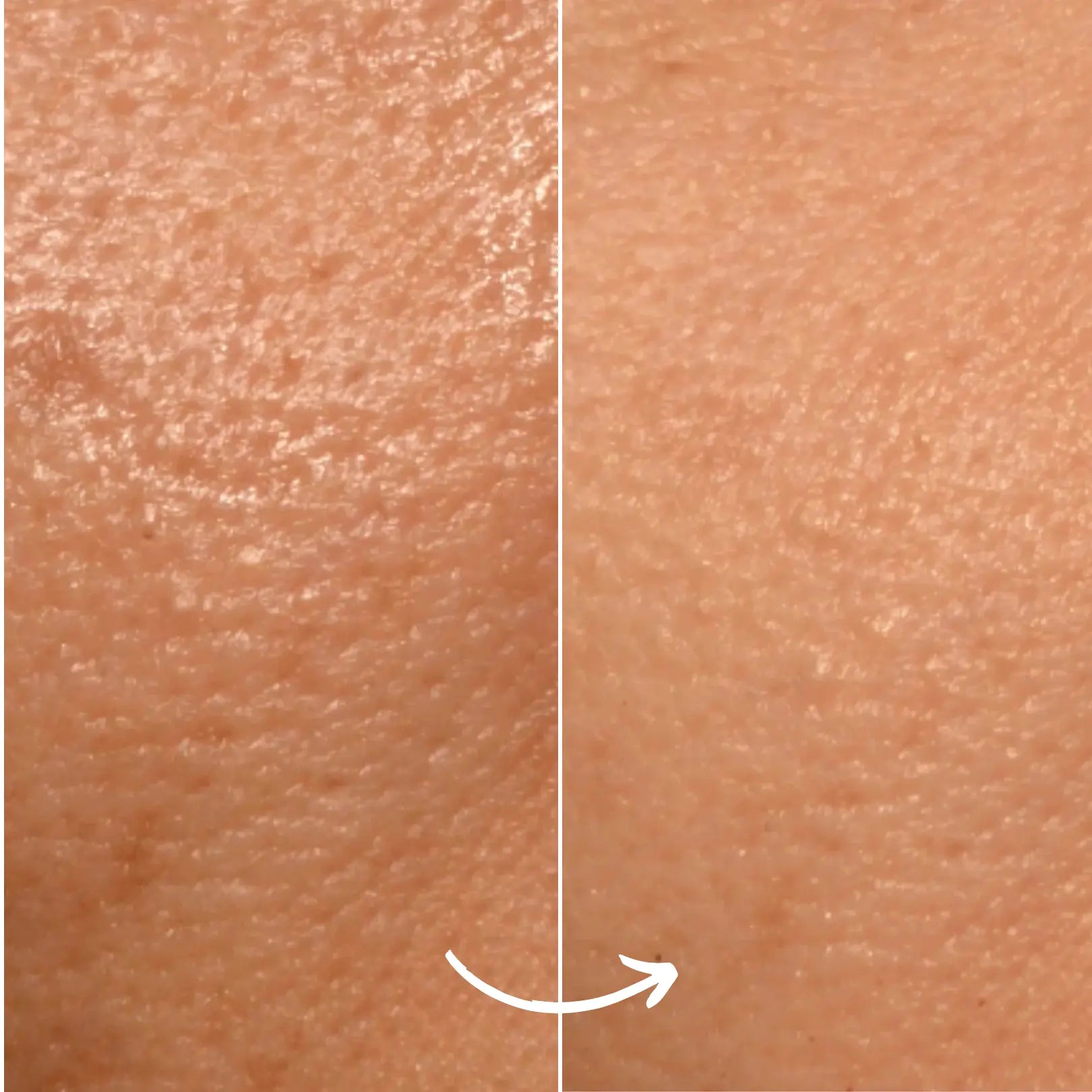SCANDIFACE Skinboosting LED mask SCANDIFACE