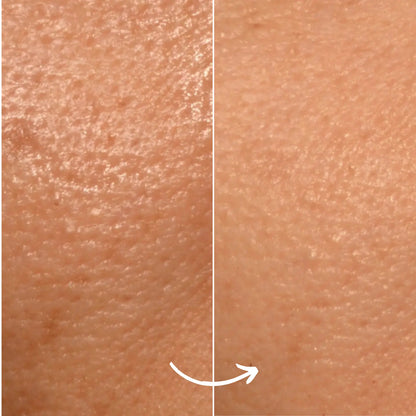 SCANDIFACE Skinboosting LED mask SCANDIFACE