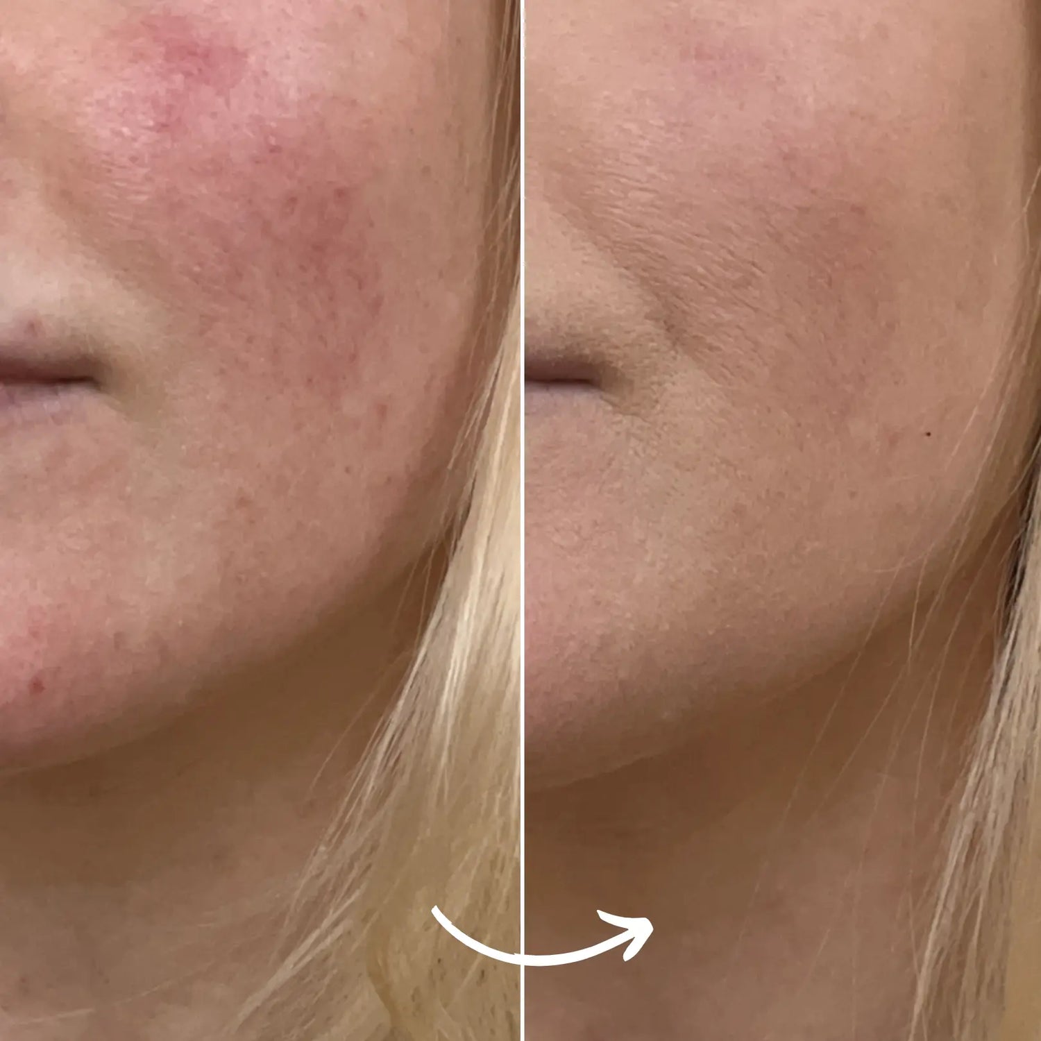 SCANDIFACE Skinboosting LED mask SCANDIFACE