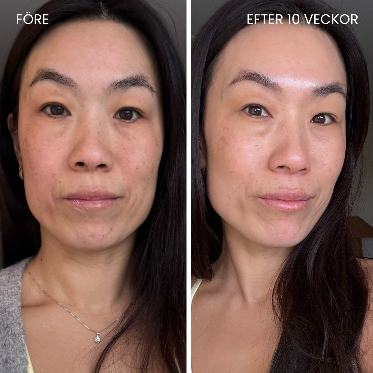 Hudboostende LED-maske