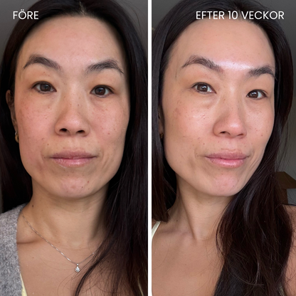 Hudboostende LED-maske